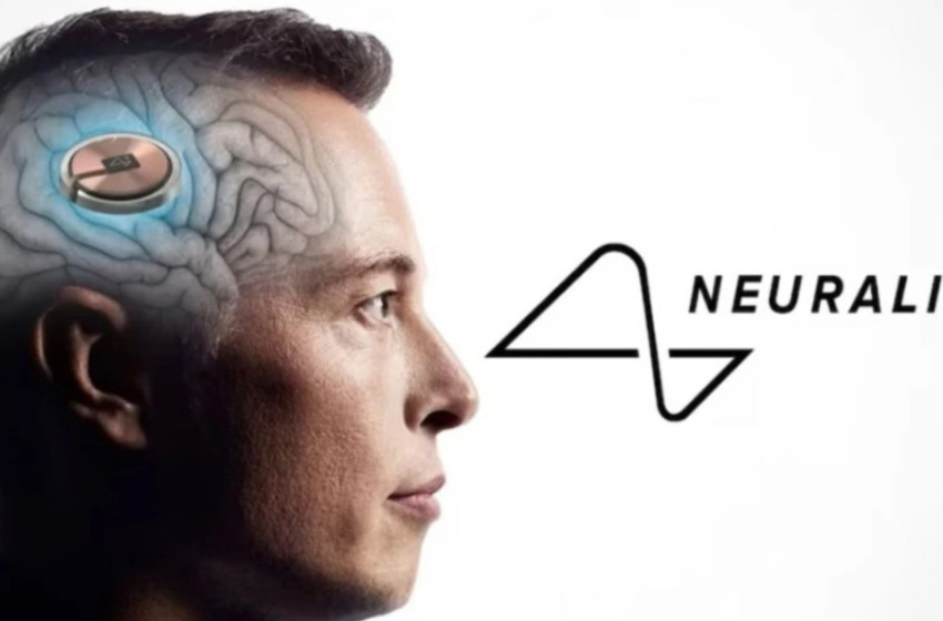 Először ültették be emberbe Elon Musk agyi chipjét